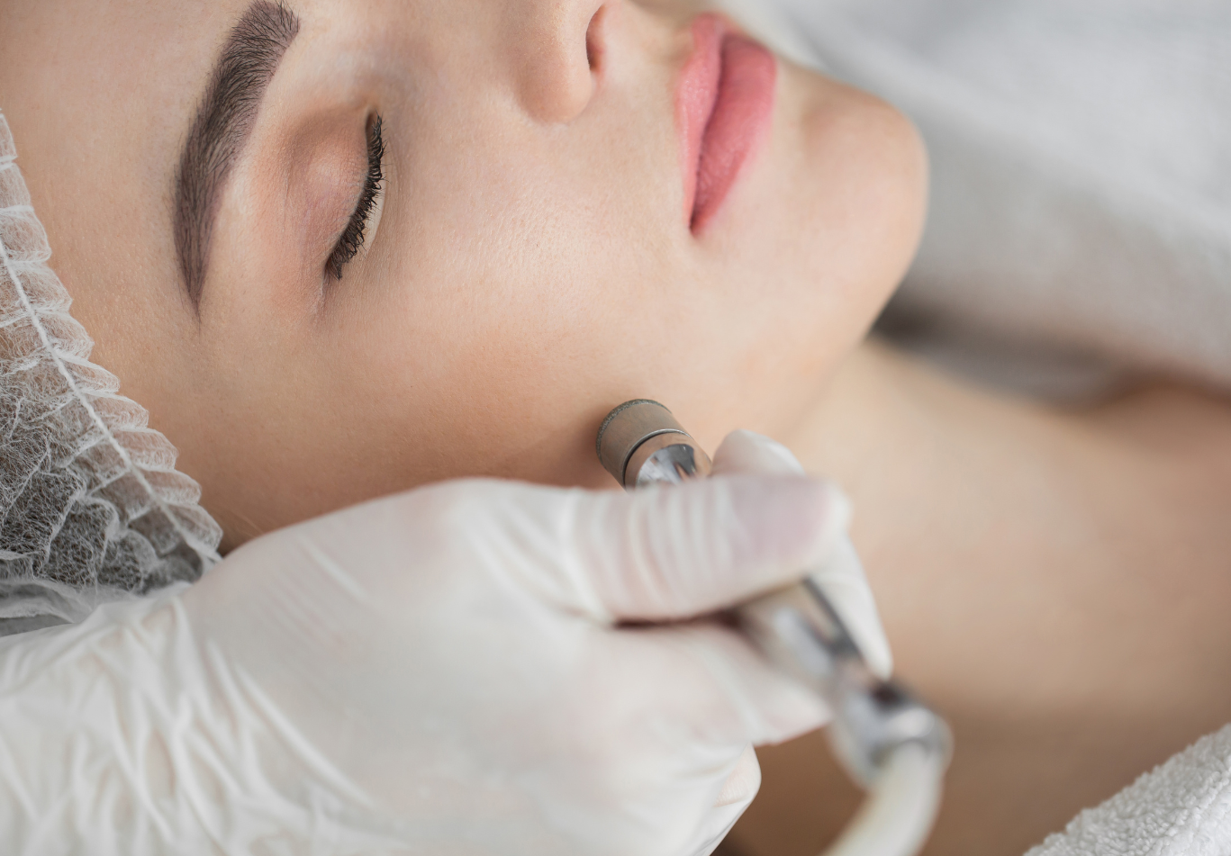 Δερμοαπόξεση