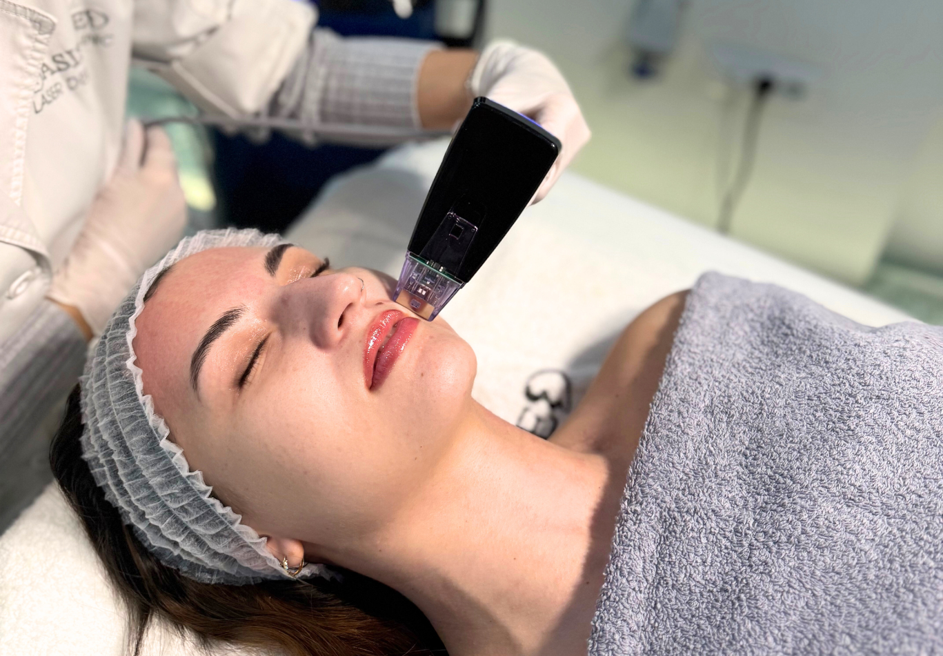 RF Microneedling