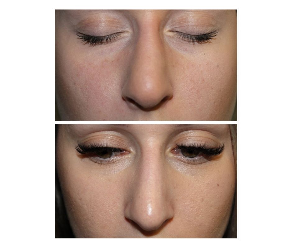 before after 15