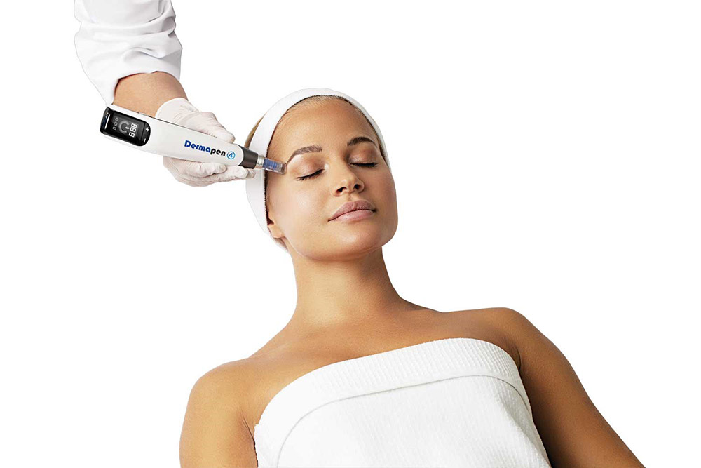 Dermapen 4™ η εξέλιξη του κλασσικού microneedling 5