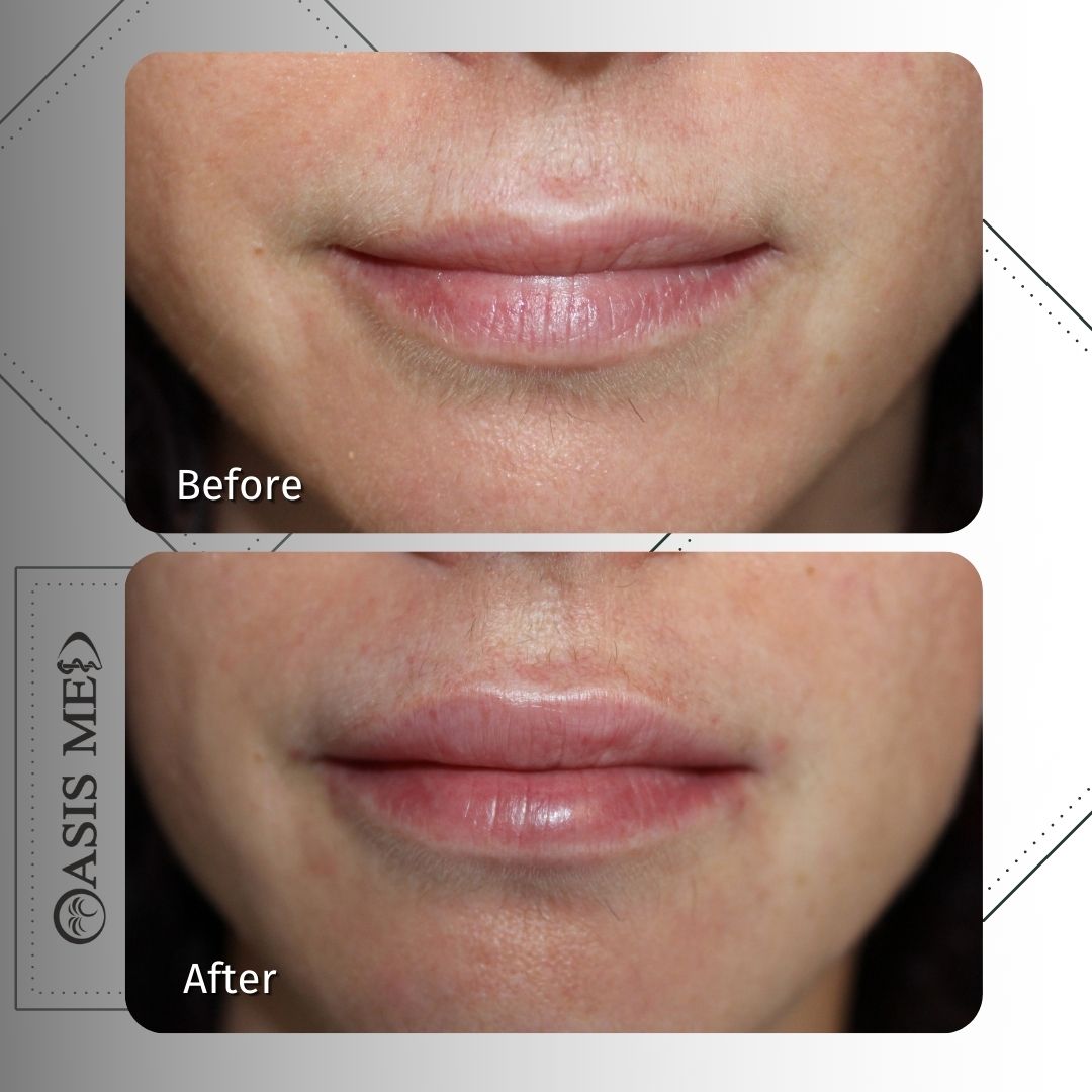 before after 29