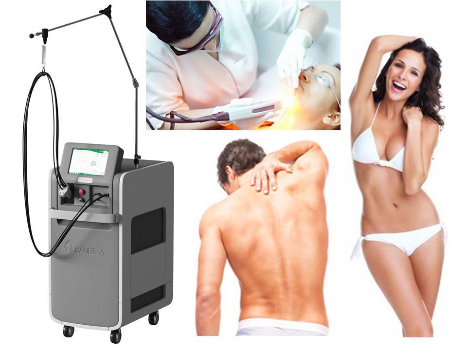 Alexandrite GentleLASE Pro™ Candela 6