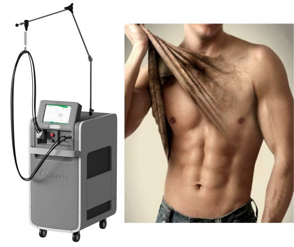 Alexandrite GentleLASE Pro™ Candela 8