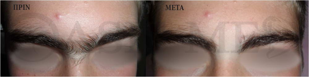 before after 8
