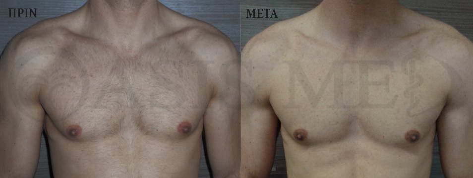 before after 7