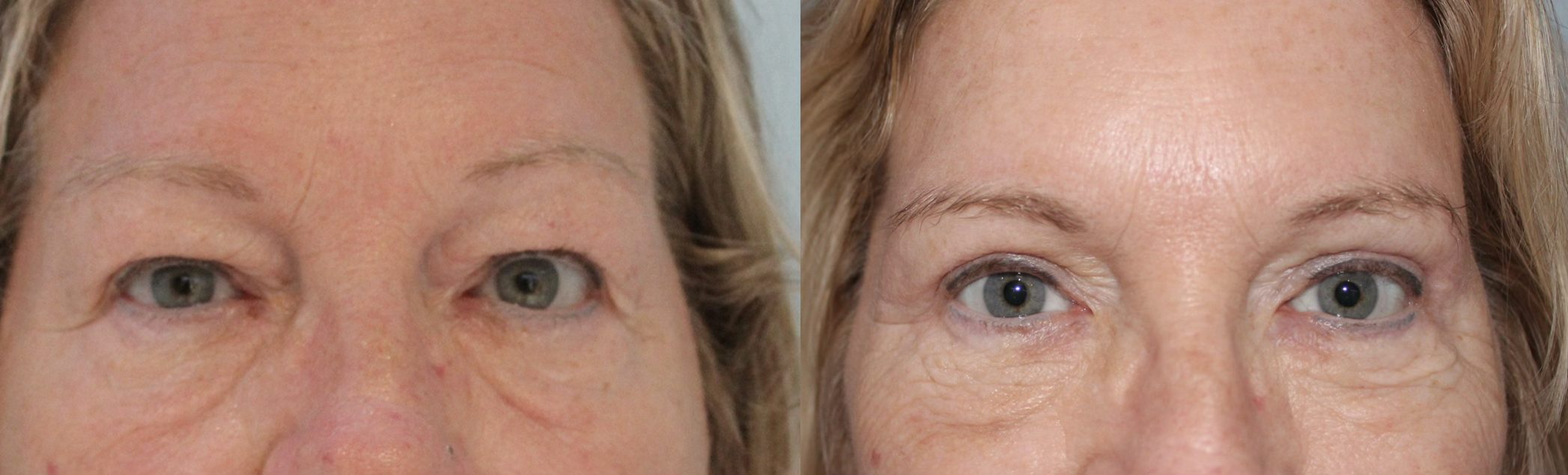 before after 3