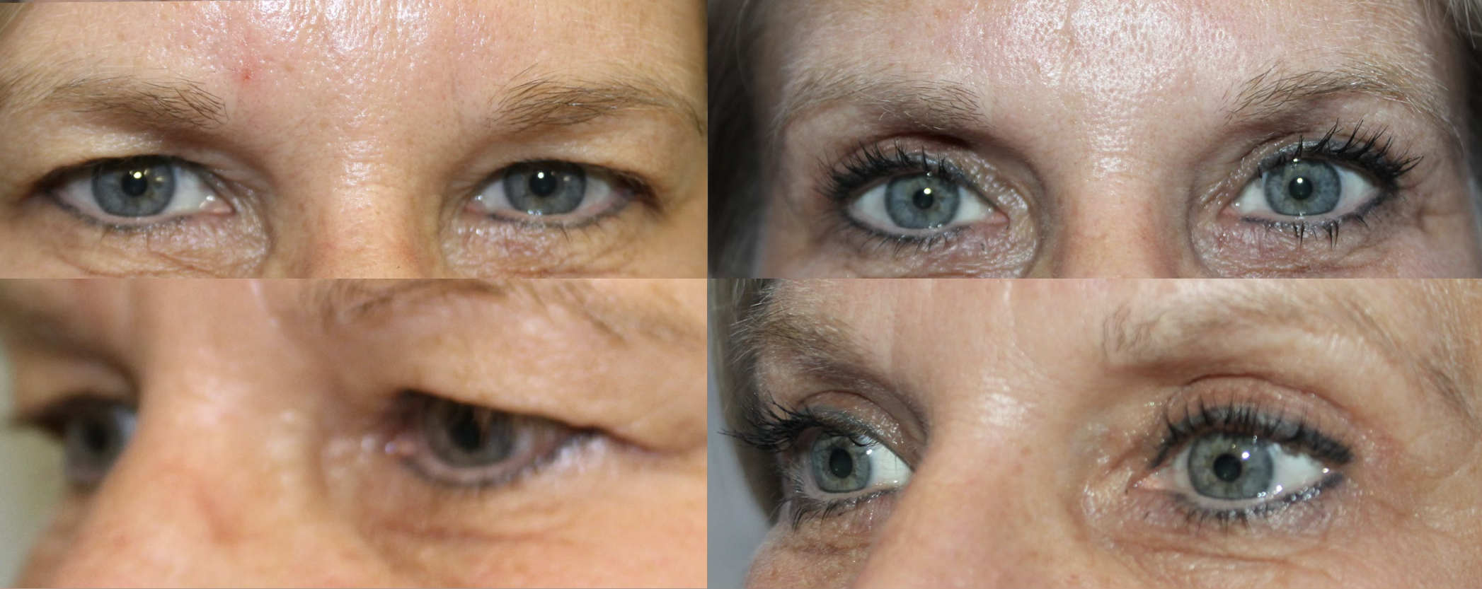 before after 4