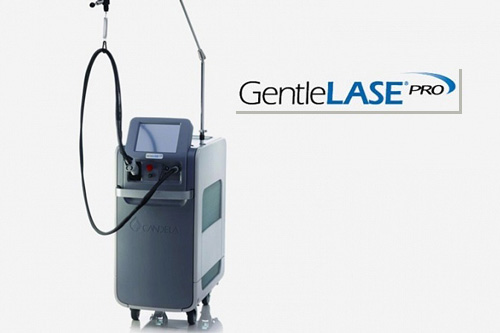 LASER Alexandrite 755nm, GentleLASE Pro, Candela