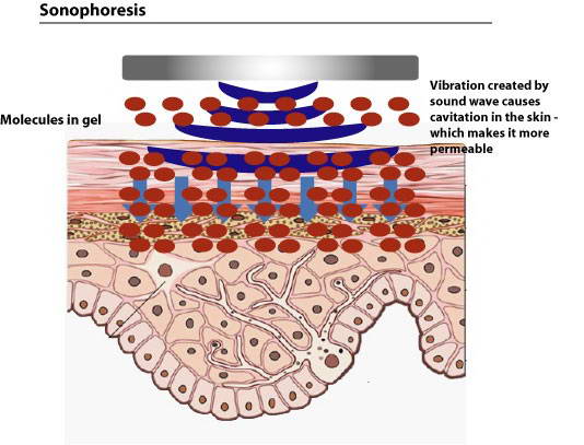 Συσκευή μη-ενέσιμης μεσοθεραπείας, Ionzyme® DF, ENVIRON™ 4