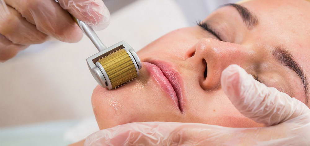 Συσκευή μη-ενέσιμης μεσοθεραπείας, Titanium MicroNeedle Dermaroller 4
