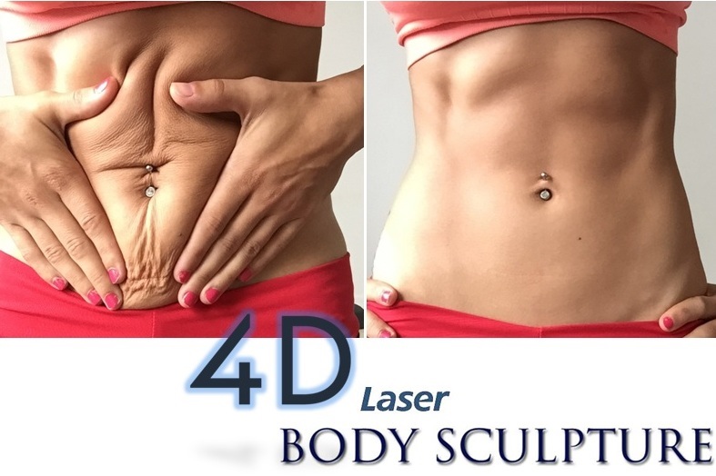 Συσκευή 4D LASER λιπόλυσης - λιπογλυπτικής, neoV1470nm  7