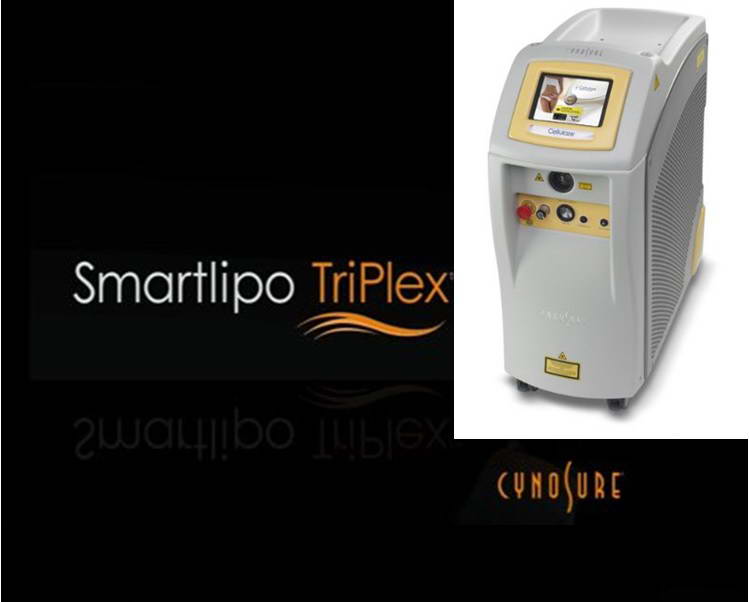 Συσκευή LASER λιπόλυσης, SmartLipo TriPlex™, Cynosure® 1
