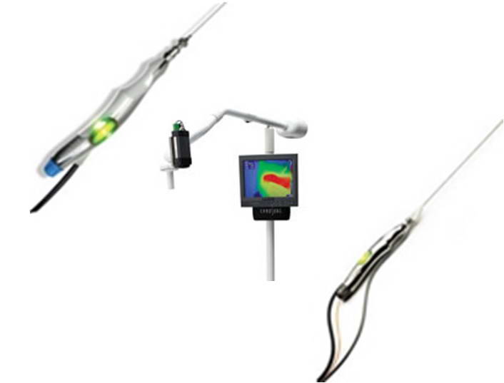 Συσκευή LASER λιπόλυσης, SmartLipo TriPlex™, Cynosure® 5