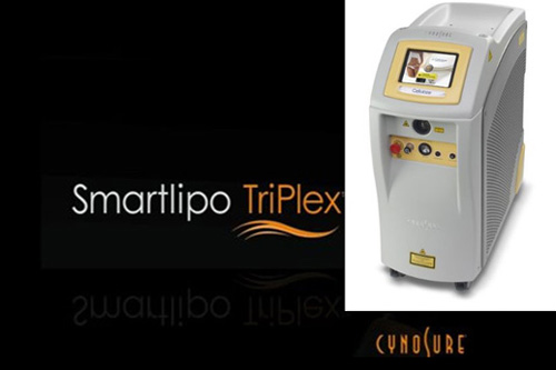 Συσκευή LASER λιπόλυσης, SmartLipo TriPlex™, Cynosure®