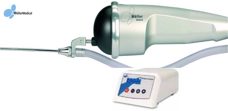 Συσκευή λιποαναρρόφησης, Möller  Medical Ltd 5