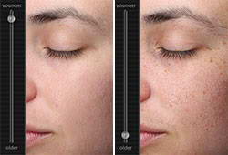 Συσκευή ψηφιακής φωτογράφησης και υπολογιστικής ανάλυσης δέρματος, Visia® 4