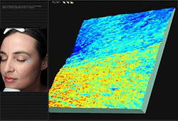Συσκευή ψηφιακής φωτογράφησης και υπολογιστικής ανάλυσης δέρματος, Visia® 5