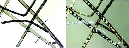 Άλλες Παθήσεις 11