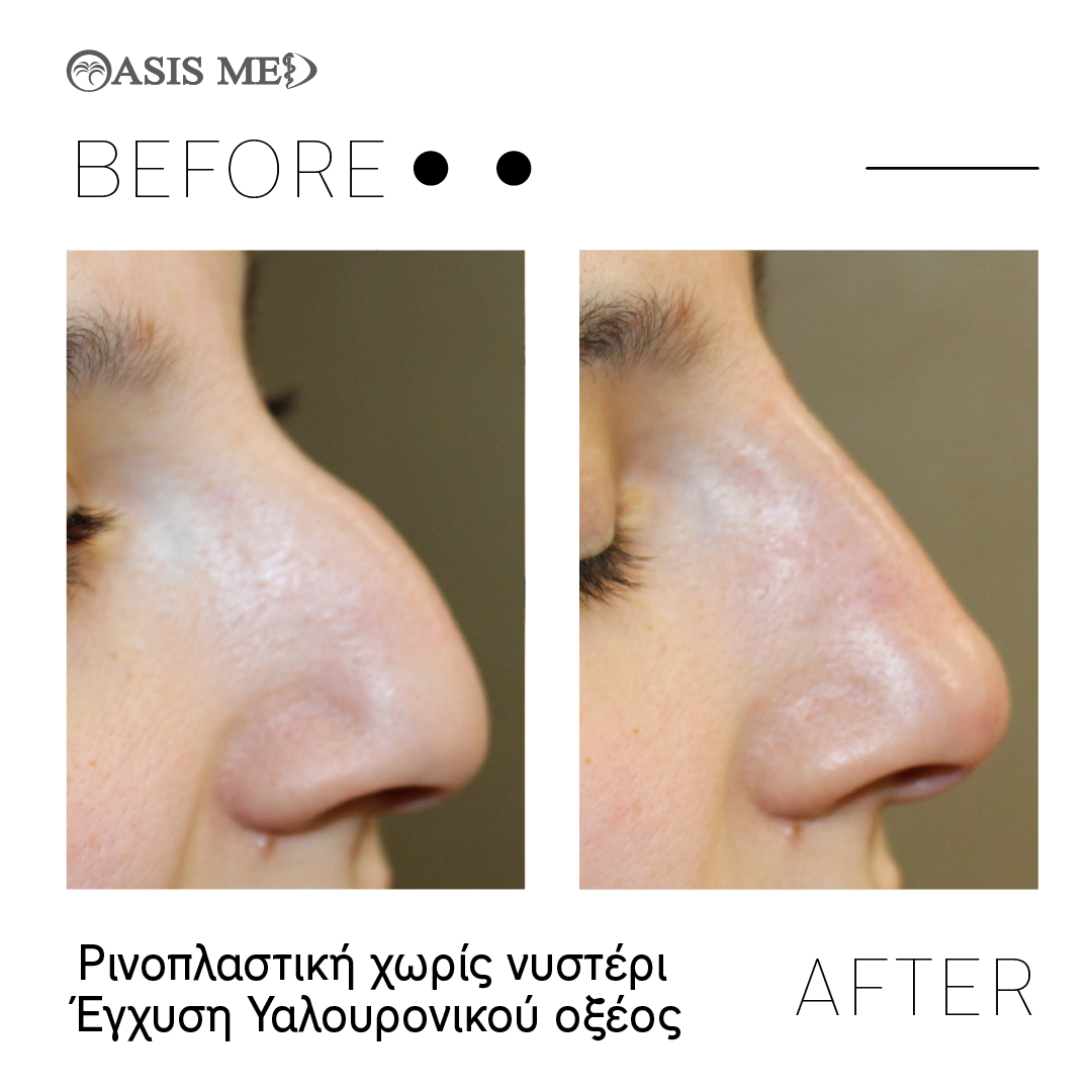 before after 8