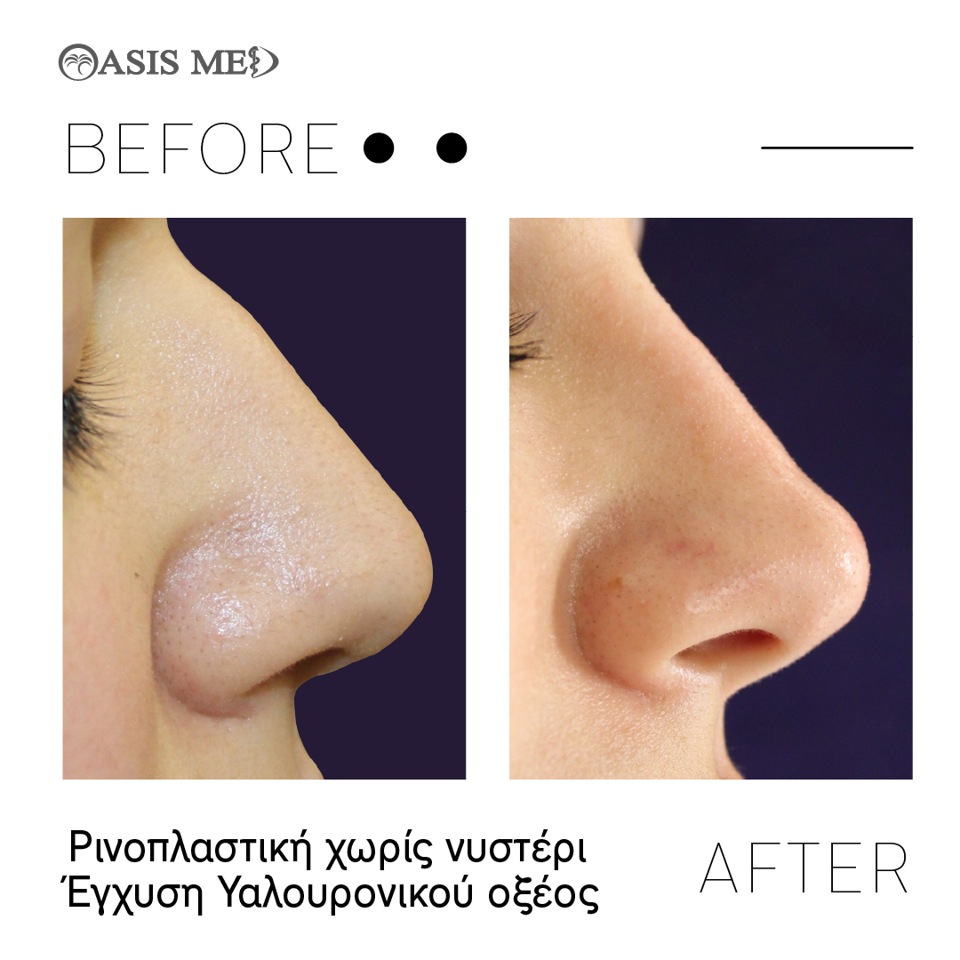before after 7