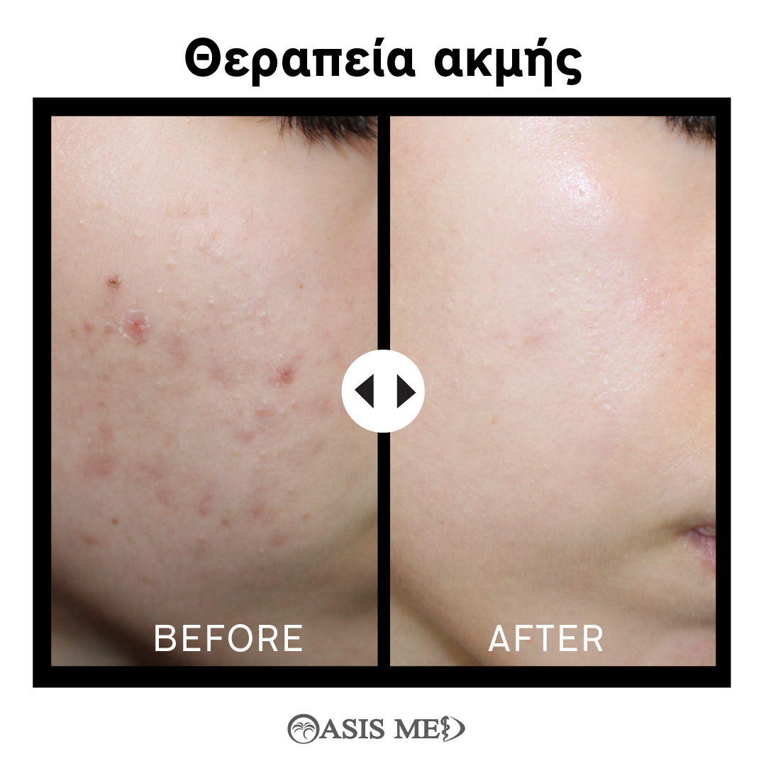 before after 3
