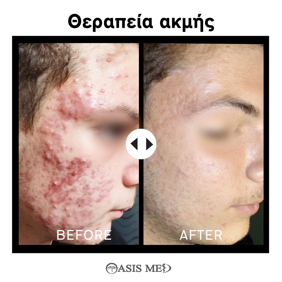 before after 2