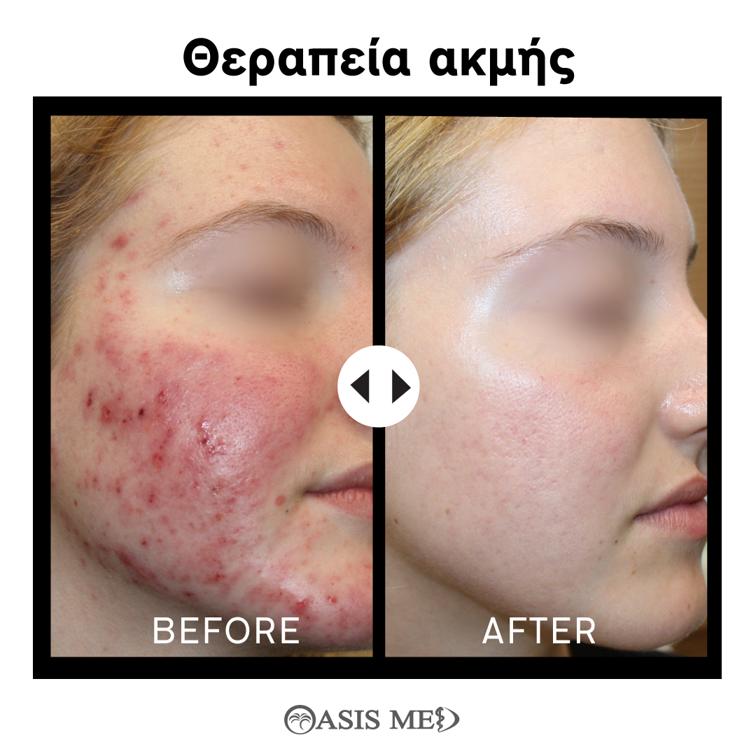 before after 4