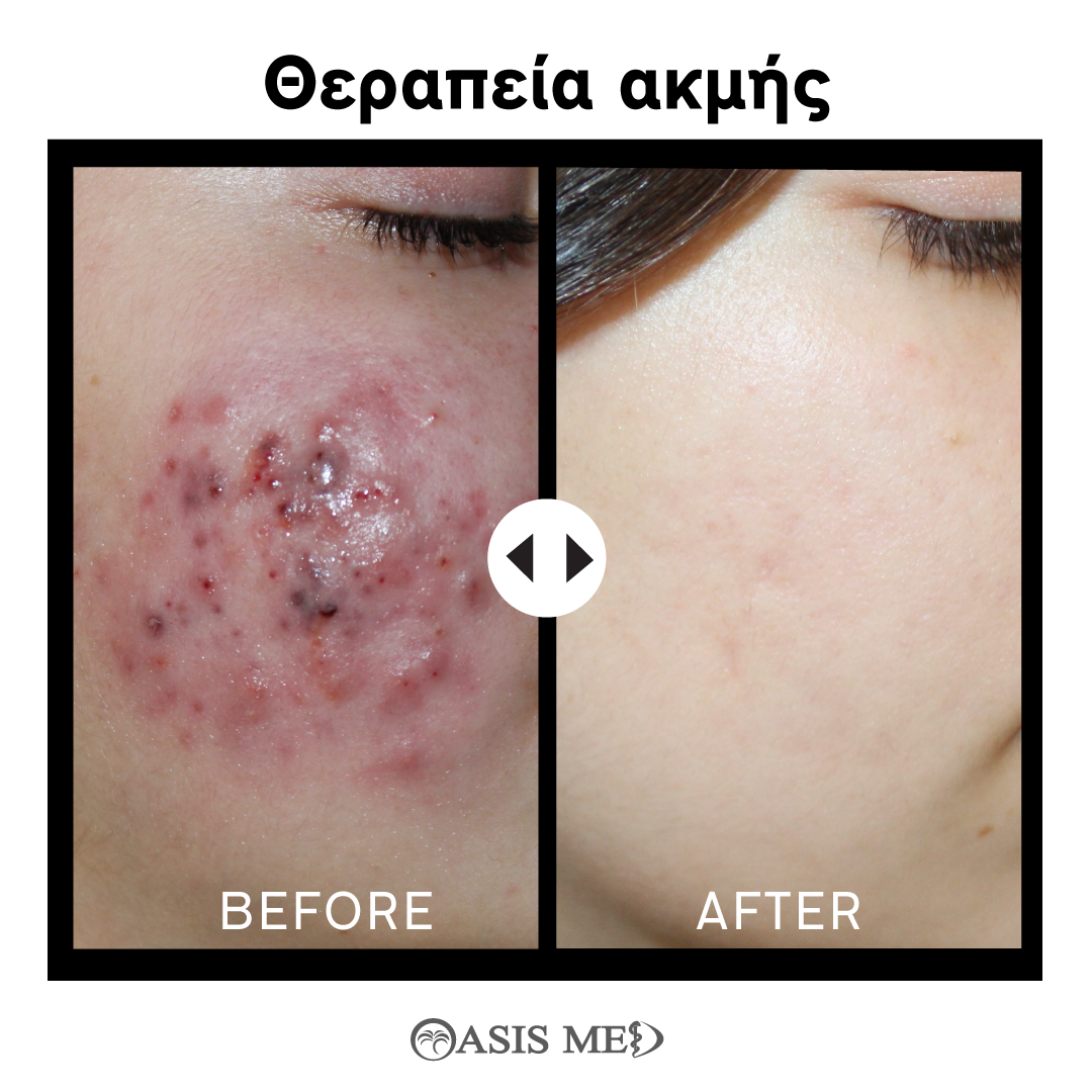 before after 5