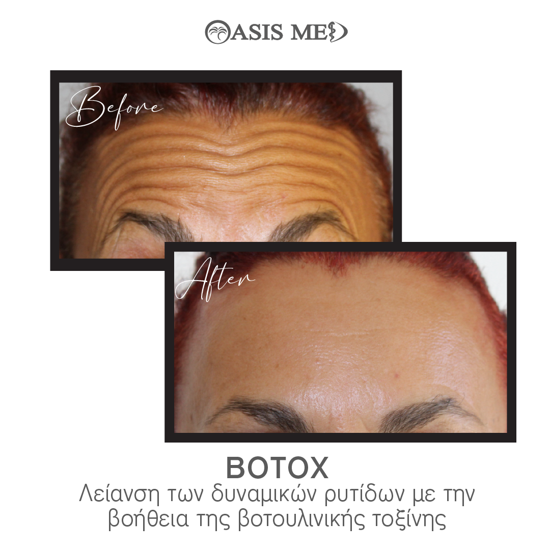 before after 12