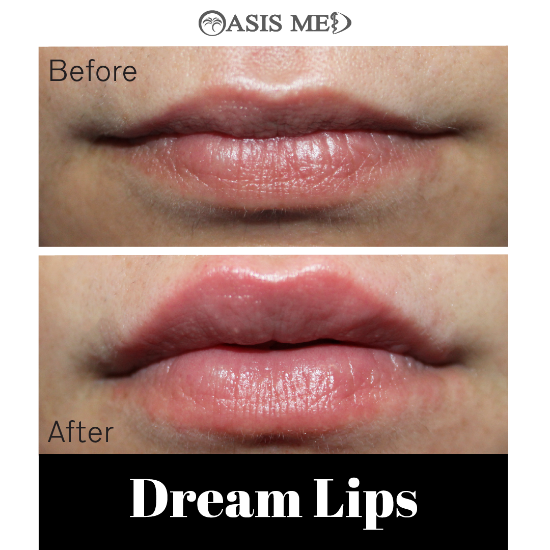 before after 3