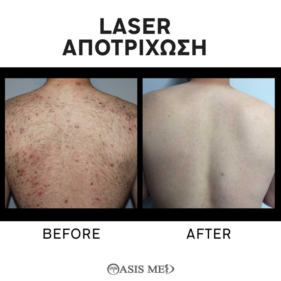before after 2