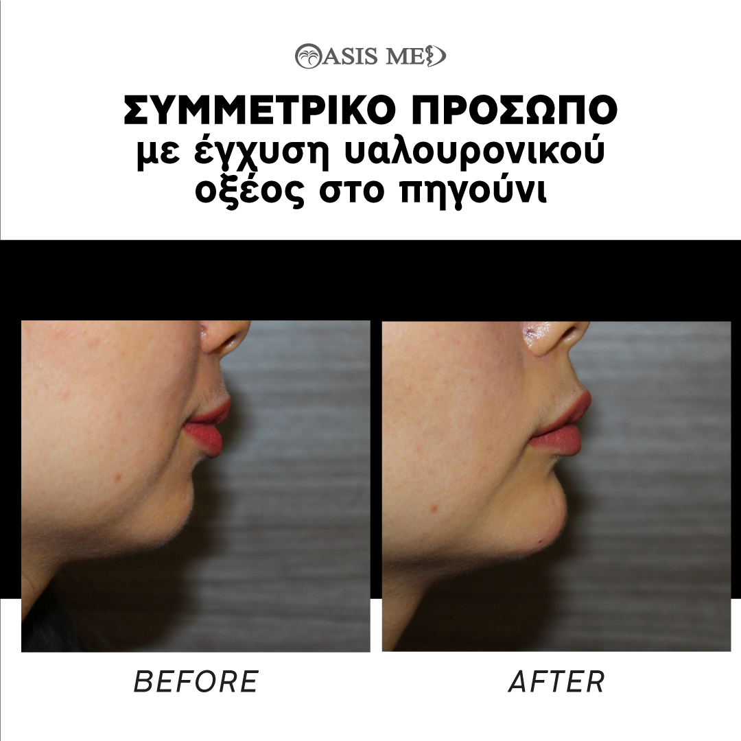 before after 5